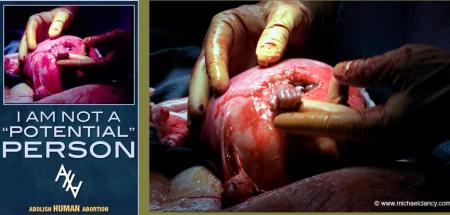 AHA Michael Clancy Image abortion