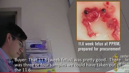 11 6 baby aborted Planned Parenthood